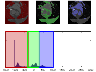 Figure 25